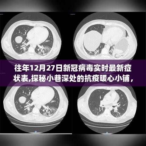 历年12月27日新冠病毒最新症状概览，暖心小铺探秘与实时症状表更新