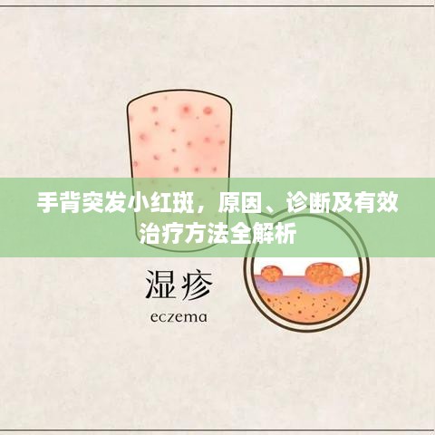 手背突发小红斑，原因、诊断及有效治疗方法全解析