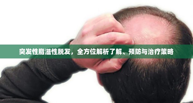 突发性脂溢性脱发，全方位解析了解、预防与治疗策略