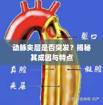 动脉夹层是否突发？揭秘其成因与特点