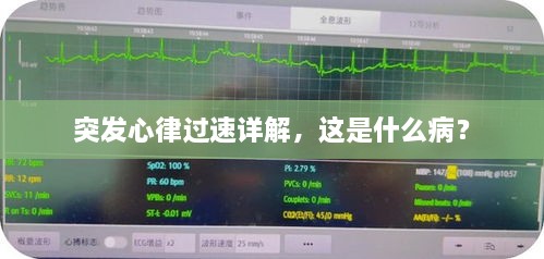 突发心律过速详解，这是什么病？