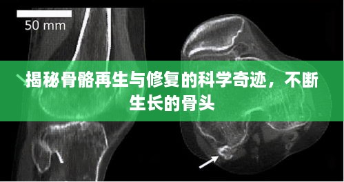 揭秘骨骼再生与修复的科学奇迹，不断生长的骨头