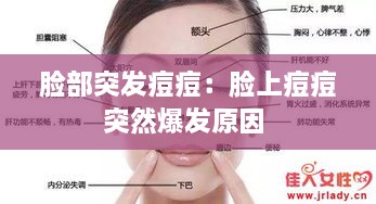 脸部突发痘痘：脸上痘痘突然爆发原因 