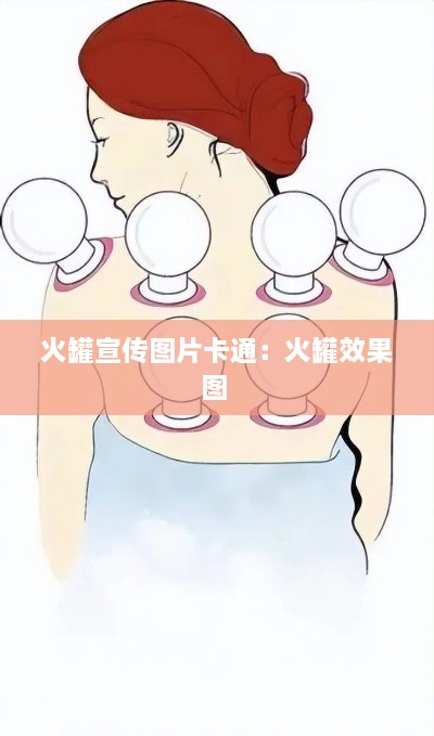 火罐宣传图片卡通：火罐效果图 