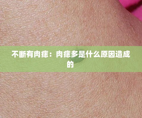 不断有肉痣：肉痣多是什么原因造成的 