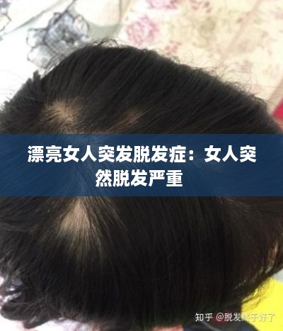 片口张舌 第2页