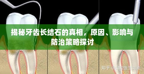 揭秘牙齿长结石的真相，原因、影响与防治策略探讨