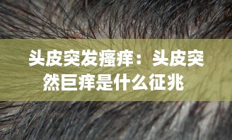 头皮突发瘙痒：头皮突然巨痒是什么征兆 