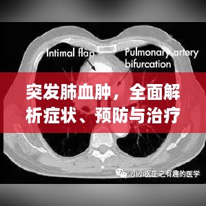 突发肺血肿，全面解析症状、预防与治疗方法