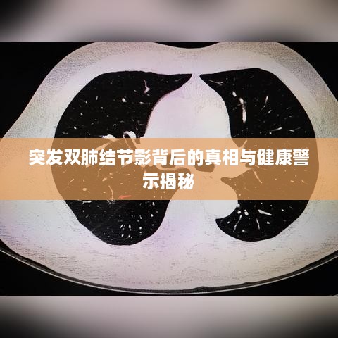 突发双肺结节影背后的真相与健康警示揭秘