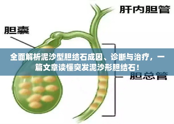 全面解析泥沙型胆结石成因、诊断与治疗，一篇文章读懂突发泥沙形胆结石！