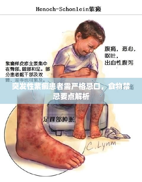 突发性紫癜患者需严格忌口，食物禁忌要点解析