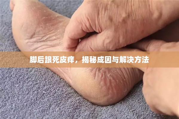 脚后跟死皮痒，揭秘成因与解决方法
