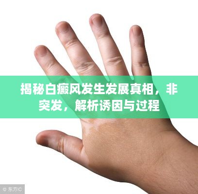 揭秘白癜风发生发展真相，非突发，解析诱因与过程